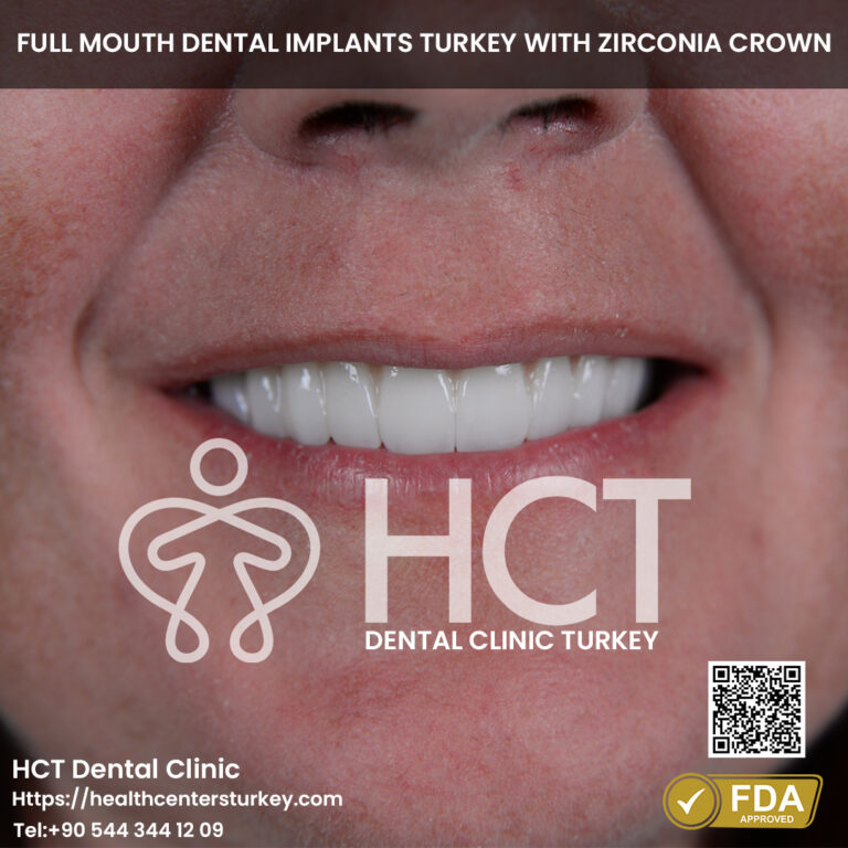 Full Mouth Dental Implants Turkey Package Deals Cost Benefits Health Centers Turkey