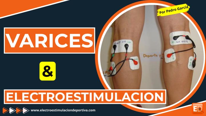 Electroestimulacion y varices.