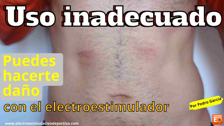 Algunas veces la electroestimulacion tiene contraindicaciones y provoca heridas por no utilizarse bien